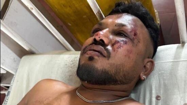 ‘Bodies around me’ - How British Man, Vishwash Kumar,  Survived Air India Crash That Killed 241 Others